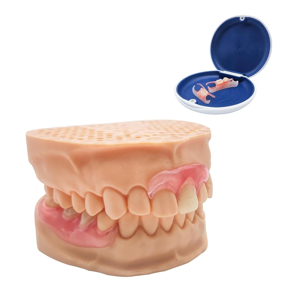 Custom Partial Dentures – Personalized Removable Denture Set for Missing Teeth