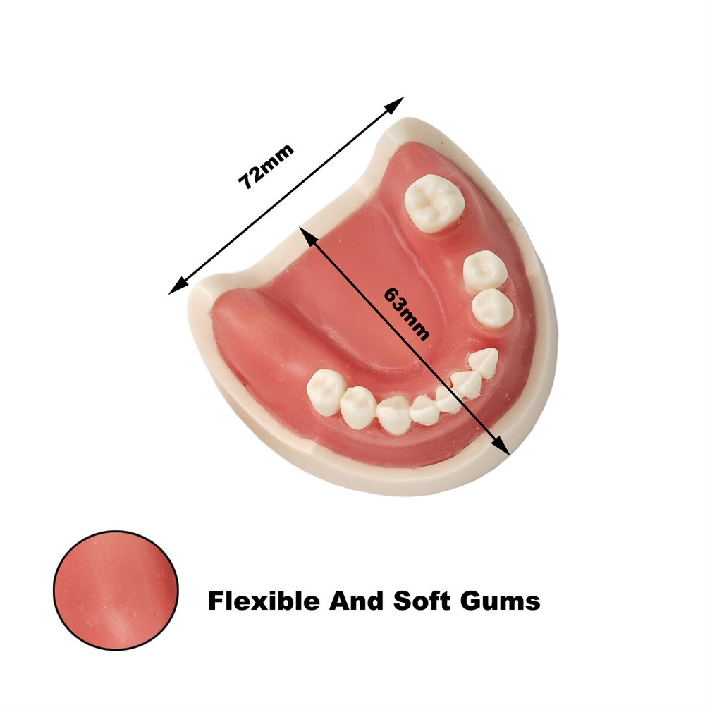 Dental Teeth Implant Practice Model For Dentistry Teaching Study Soft Gums