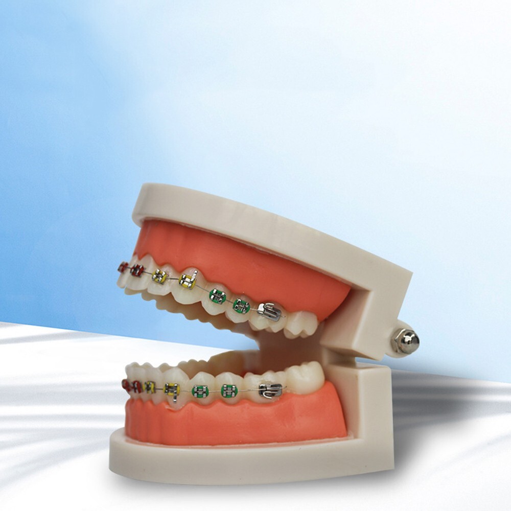 Dental Typodont Orthodontic Treatment Teeth Model Malocclusion Study w/ Bracket