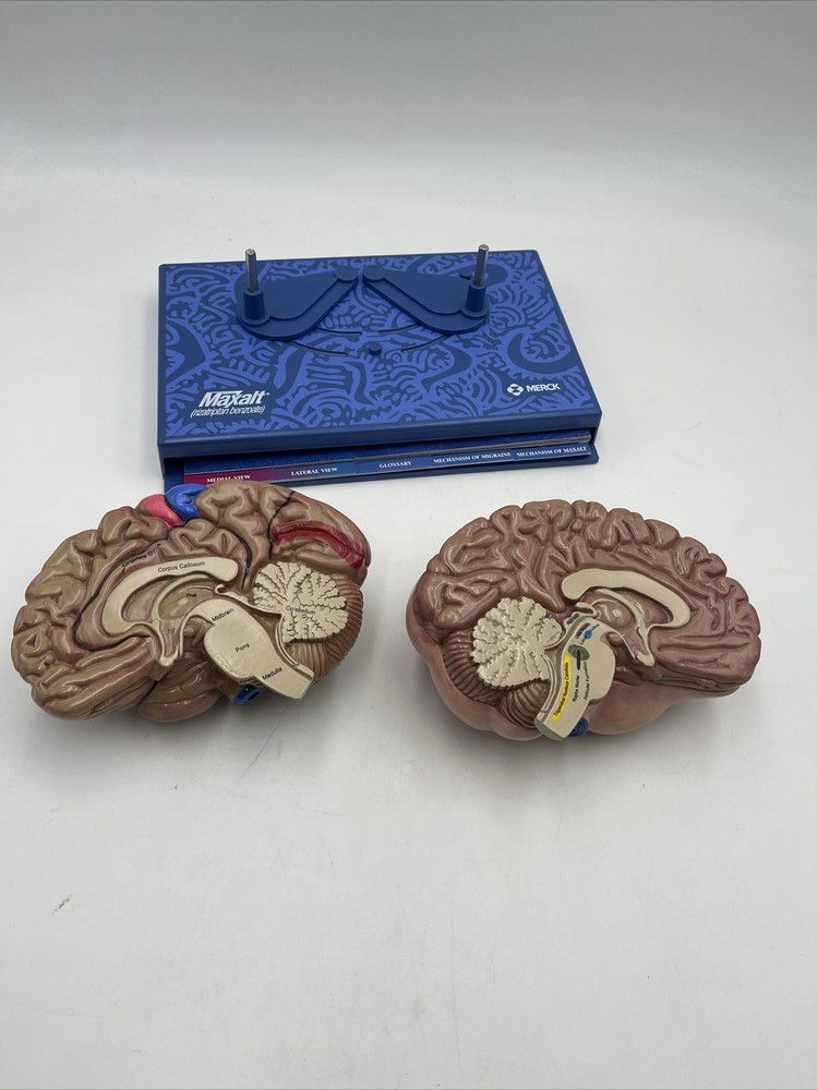 Maxalt Brain Anatomical Model Migraine Pathology Education Teaching Model