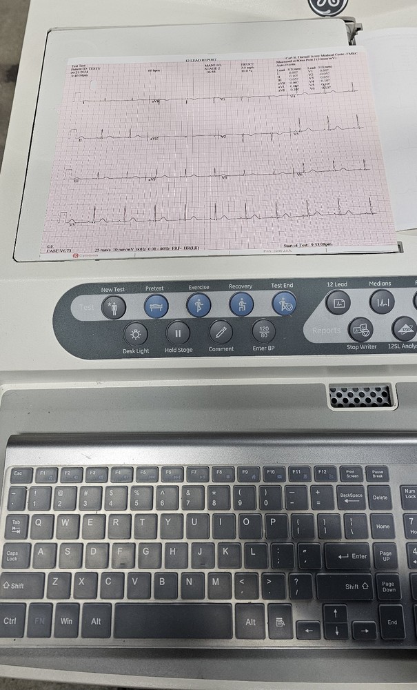 GE Case Stress System Windows 10 Ver.6.73