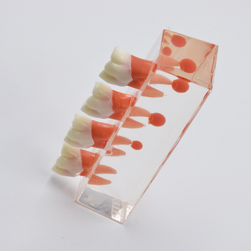 Dental Study Teaching Model Periodontal Caries Disease Teeth Dentoform Typodont
