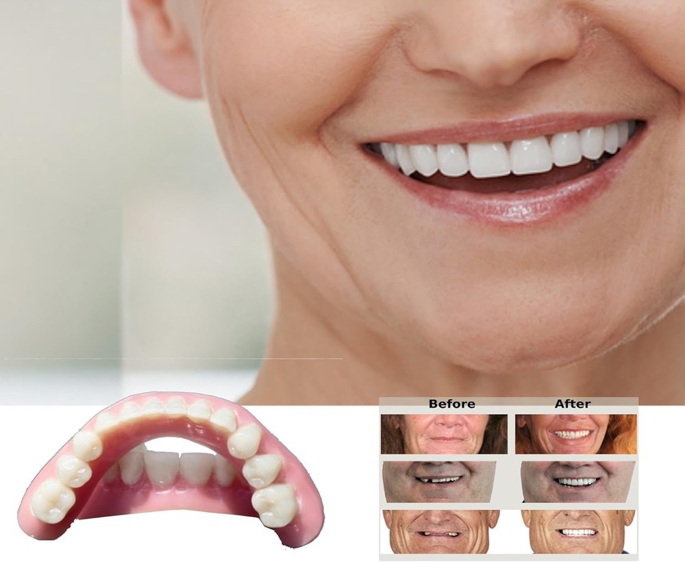 DIY Denture Kit with Impression(2 Sets of False Teeth) Small