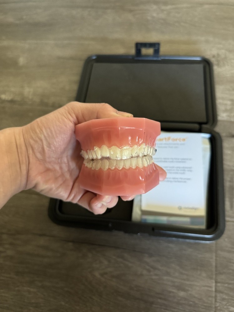 Invisalign Demo Typodont Kit - Class 2