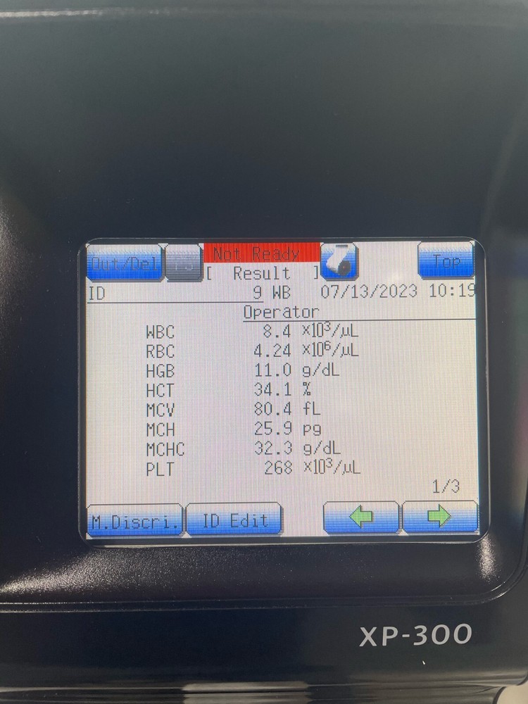 Sysmex XP-300 Automated Hematology Analyzer