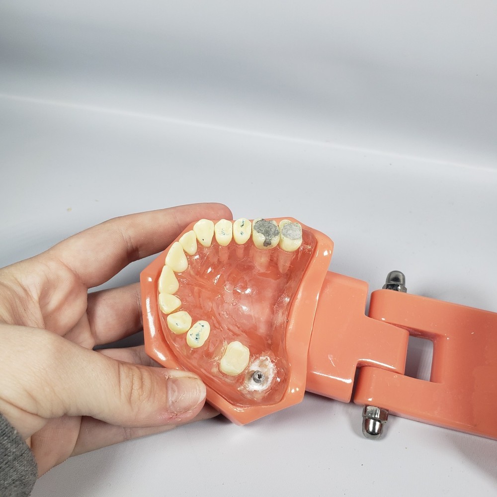 Vintage Training Dental Teeth Model with Removable Teeth (Incomplete)
