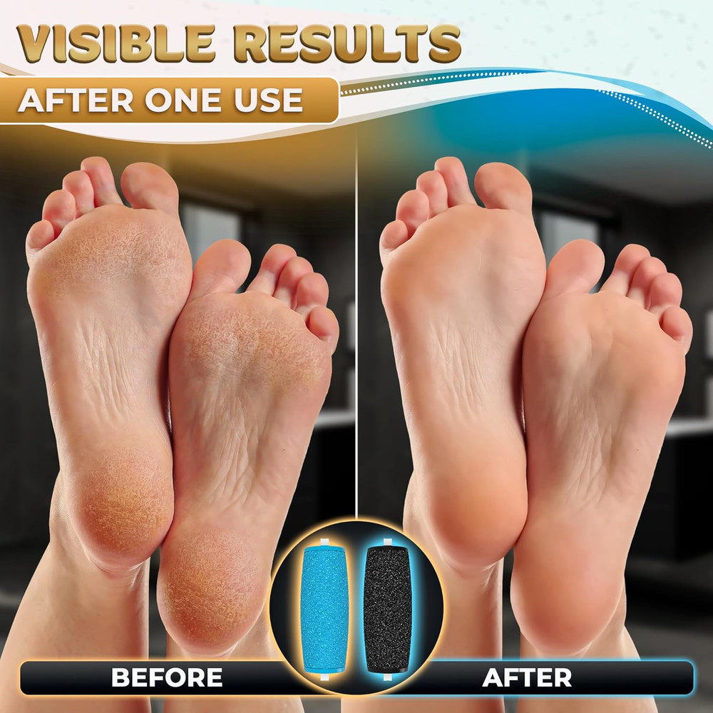 11 Pcs Replacement Rollers for Electric Foot Callus Remover Tool - 7 Extra Coars