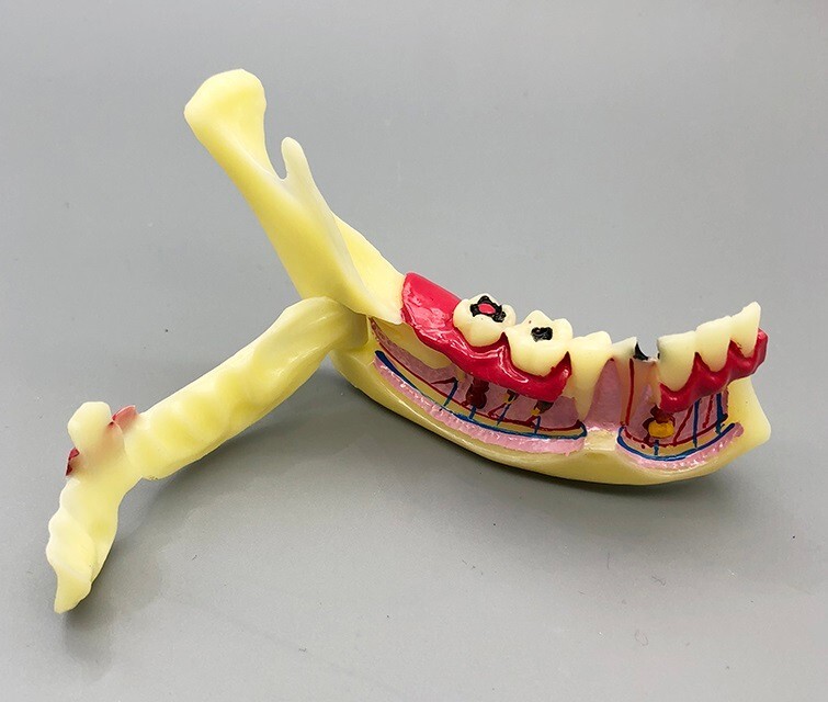 Dental Mandibular Tissue Teeth Anatomical Model Patient Teach Study Model