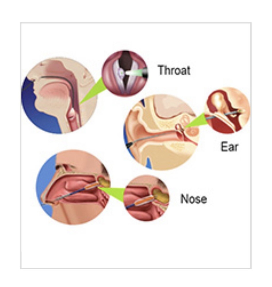 dental soft tissue laser