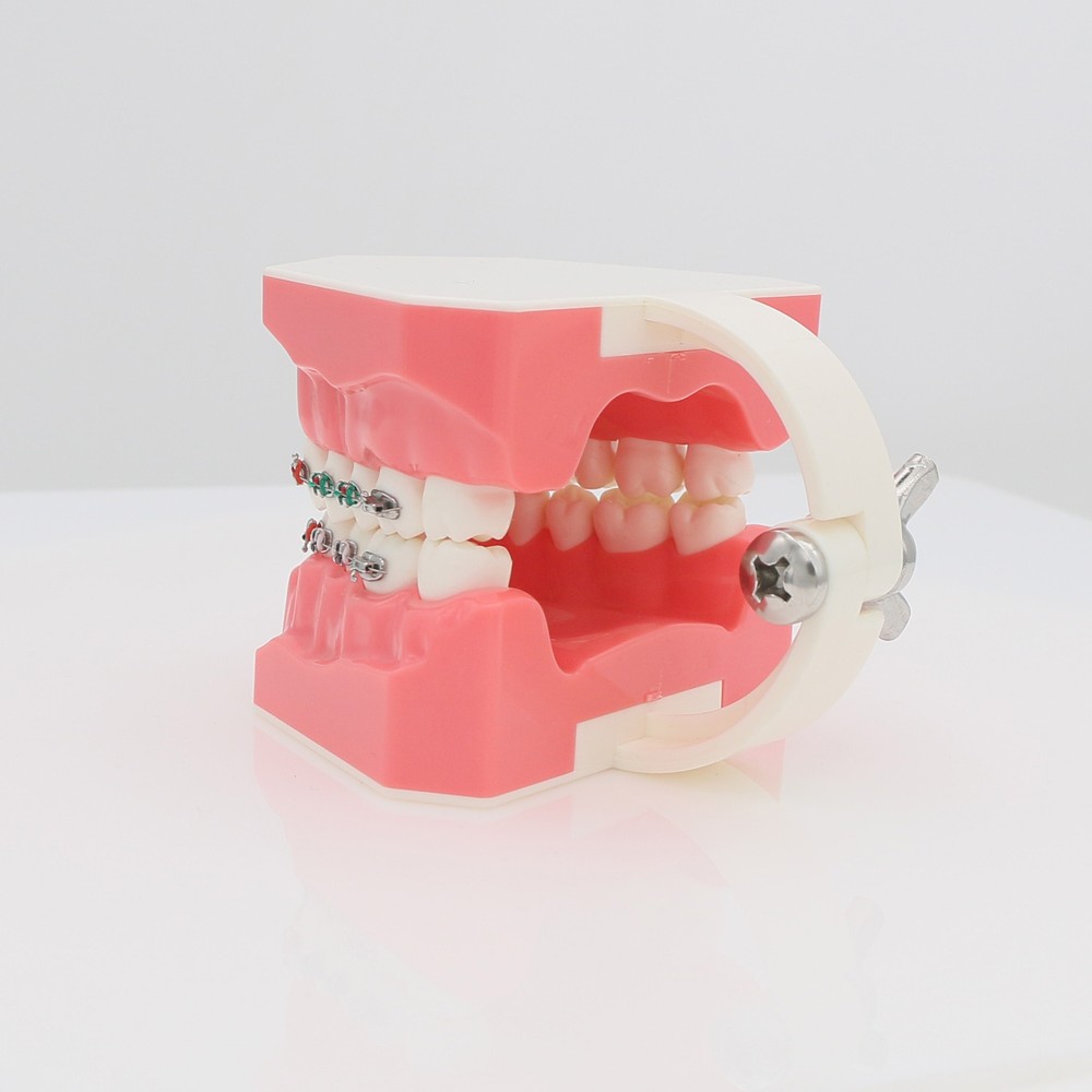 Dental Orthodontic Teeth Model Typodonts Model Demonstration Model with Brackets
