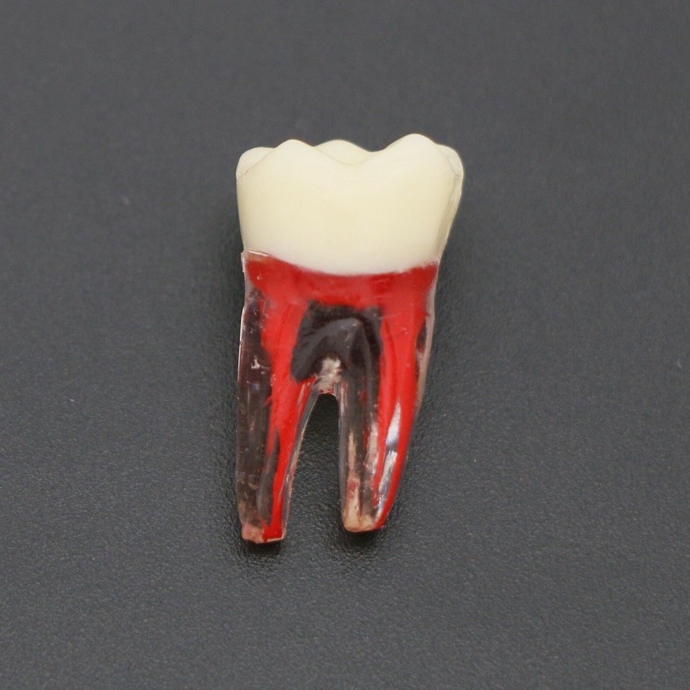 US Dental Root Canal Practice Model Teeth Pulp Study RCT Endo File 7 Sizes