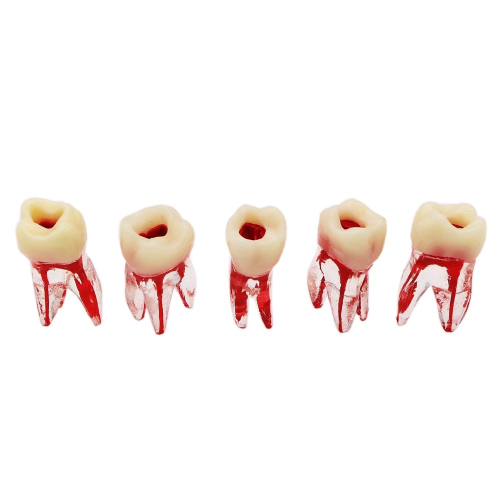 Dental Typodont Endodontic Practice Pulp-Opened RCT Root Canal Teeth Model M8008