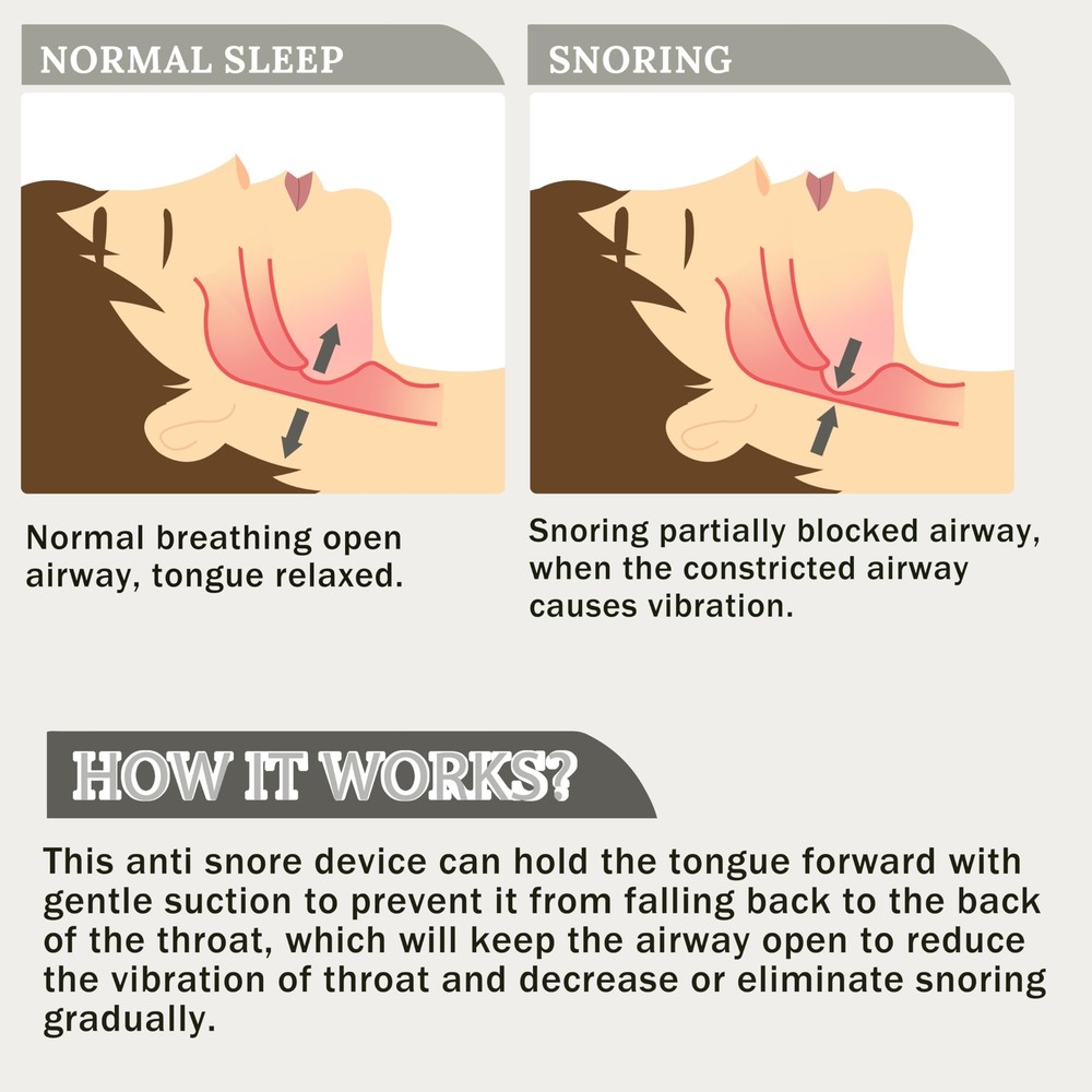 Silicone Anti Snoring Device Anti Snoring Solution For Better Nighttime Sleeping