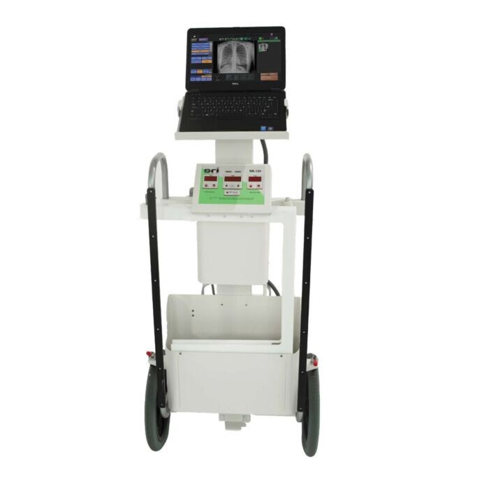 SR-130 digital Portable ray System source ray