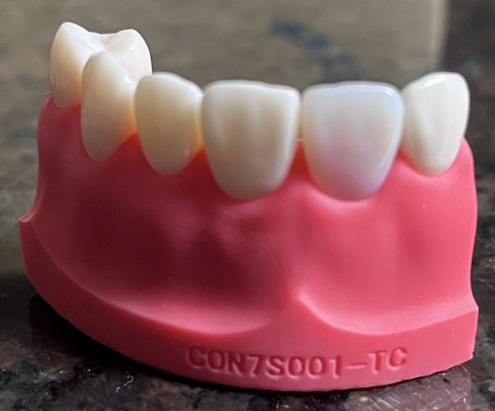 Kilgore ADEX Endo Typodont Tooth #8 Practice