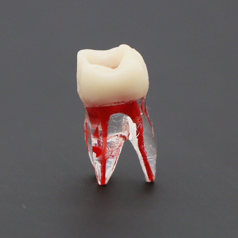 Dental Molar Endo Root Canal Study Model RCT/MTA Practice Block Pulp Cavity