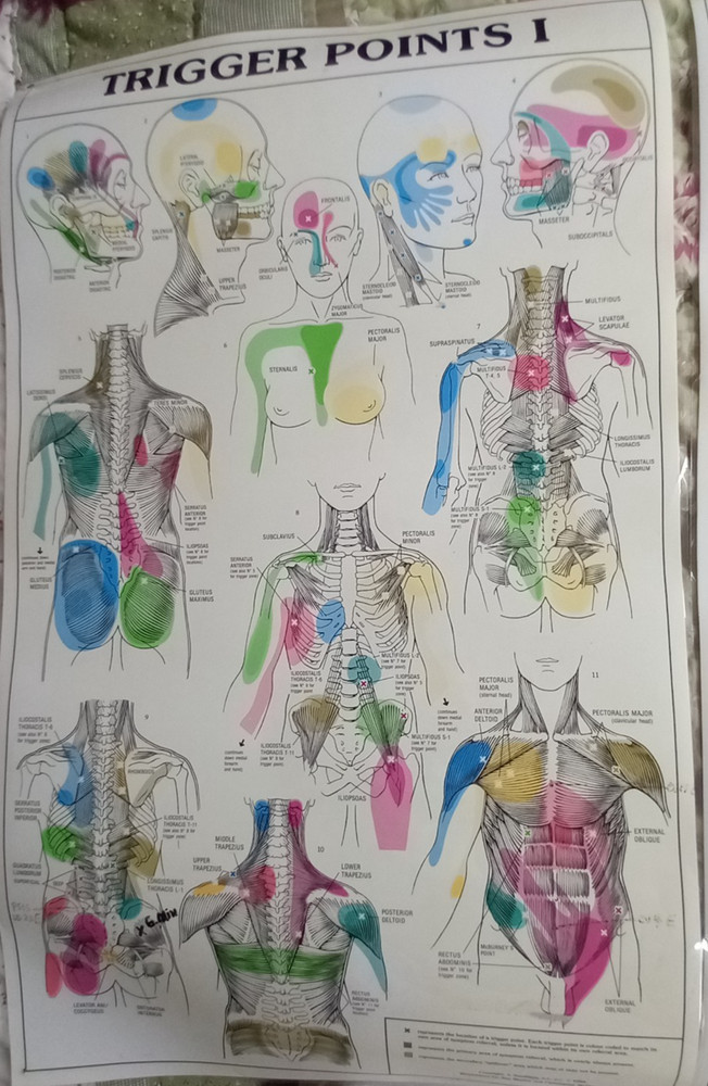 VTG   90s  Smoulders  Trigger Points  1 & 2  , laminated charts   21"x 34"