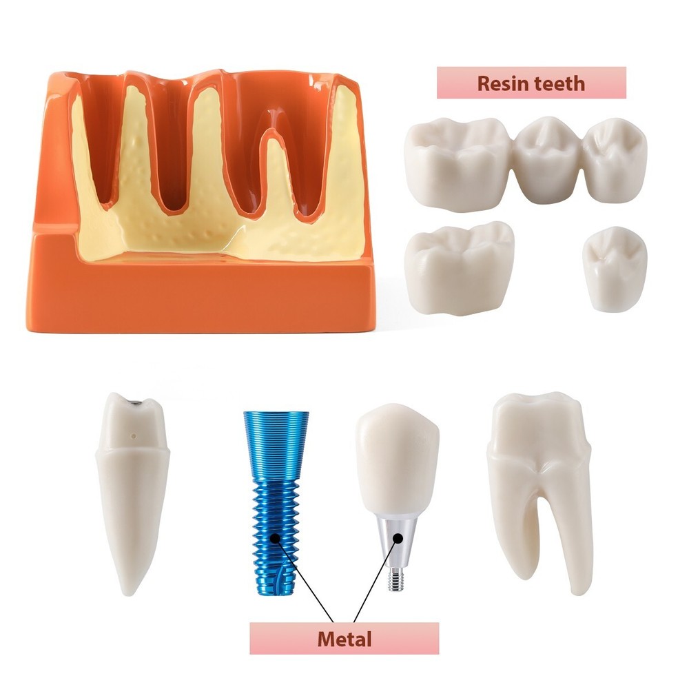 4 Times Dental Analysis Crown Bridge Demonstration Removable Teaching Model