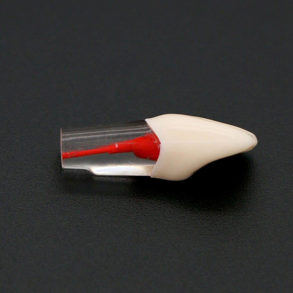 Dental Teeth Root Canal RCT Block Pulp Cavity Practice Model for Endo File Study
