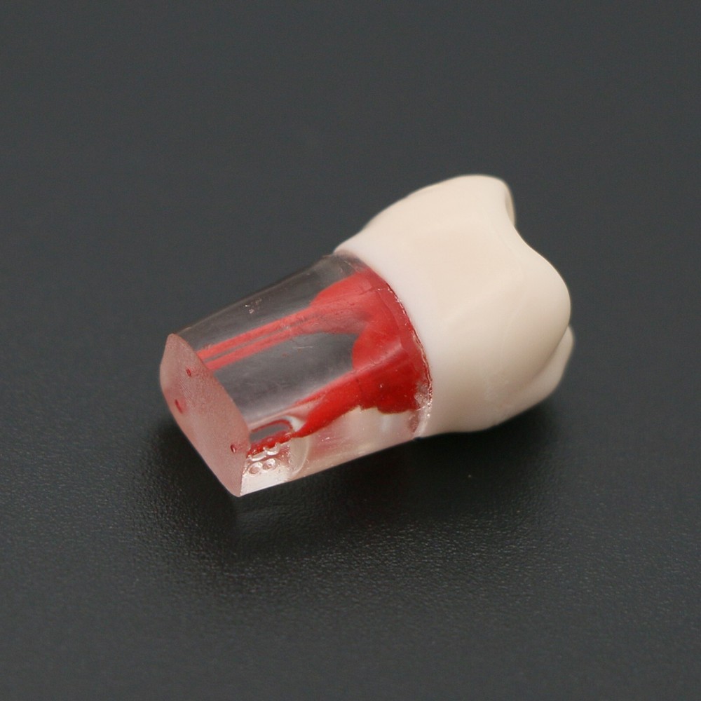 Dental Teeth Root Canal RCT Block Pulp Cavity Practice Model for Endo File Study
