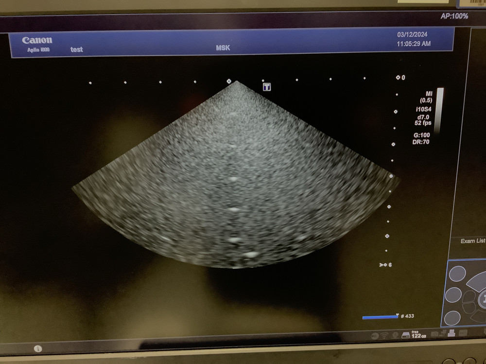 2017 Toshiba PSI-70BT Phased Array Ultrasound Probe