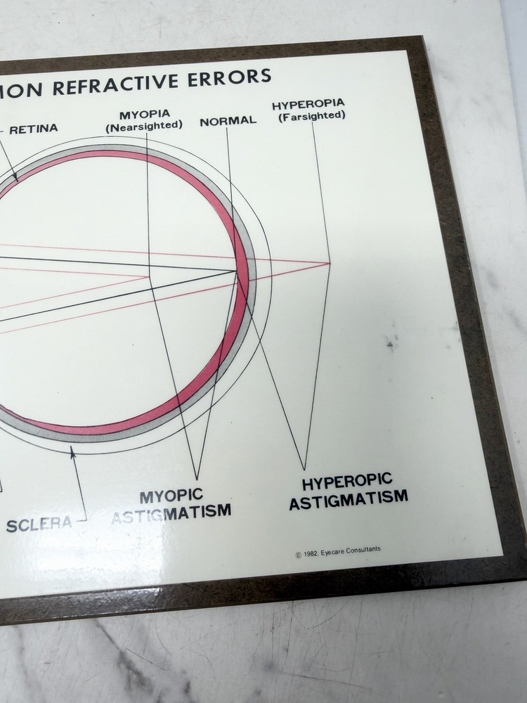 Vintage Optometry Eye Chart Board Common Refractive Errors Teaching Display