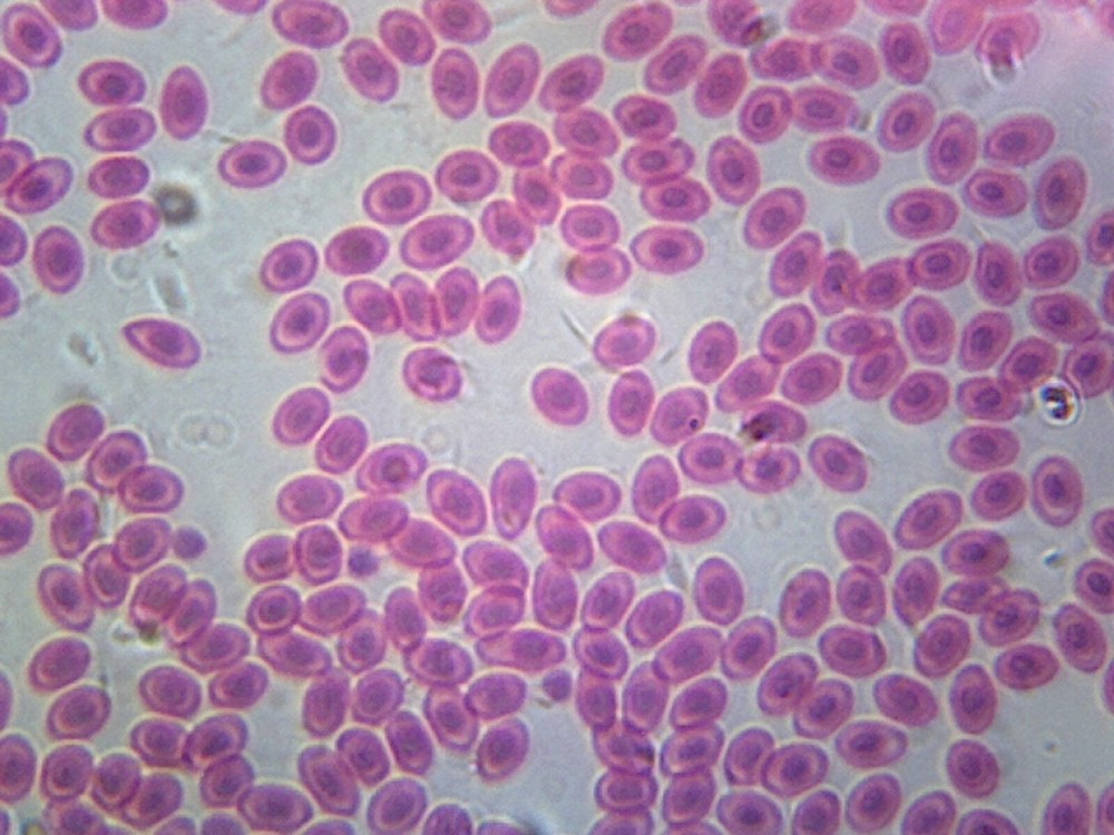 Frog Blood; Smear