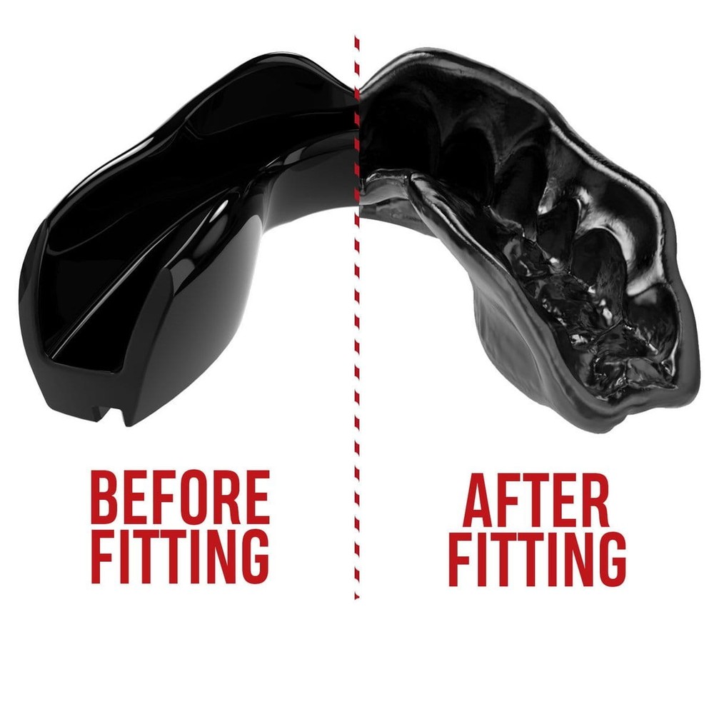 Safejawz Teeth Protector Intro Black+ Box