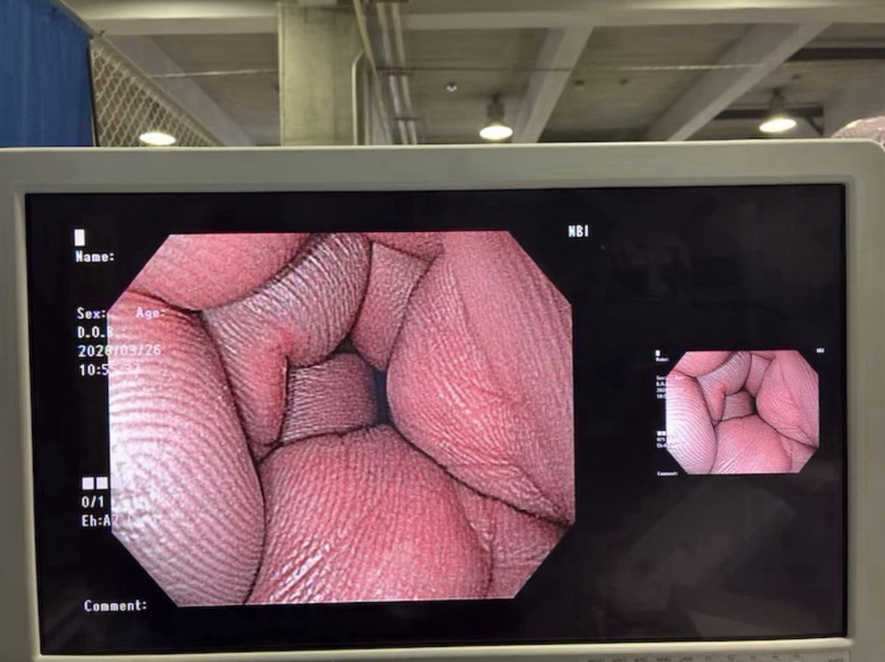 Endoscope system CV-190 / CLV-190PLUS OLYMPUS