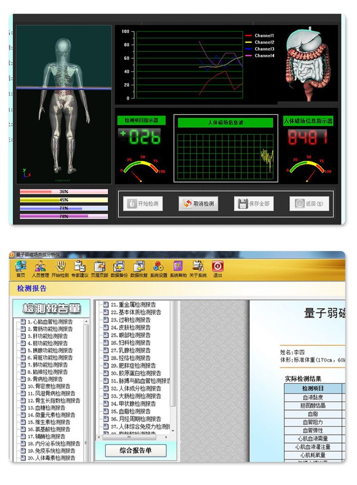 2025 Newest Professional Quantum Analyzer With 52 Reports-English & Spanish
