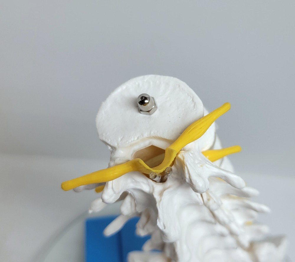 Nevro Medical Spine Model Display