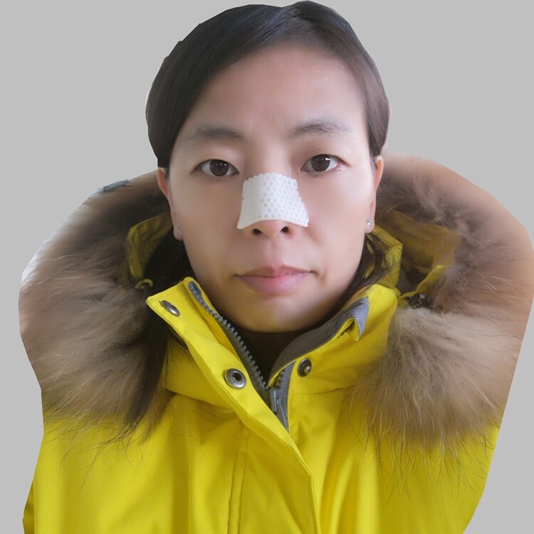external thermoplastic nasal splints Trapezium 1.6mm 30pcs