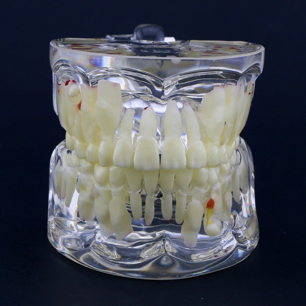 Dental Children Pediatric Pathology Demonstration Study Tooth Teeth Model 4002