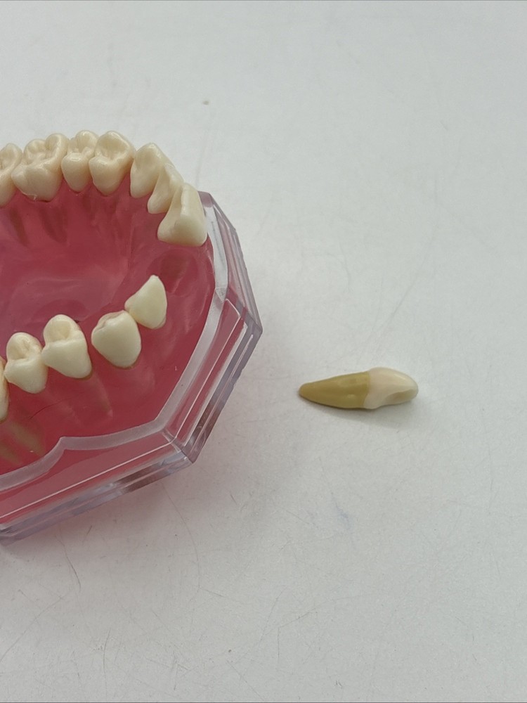 Dental Typodont Practice Removable Teeth Model M7008