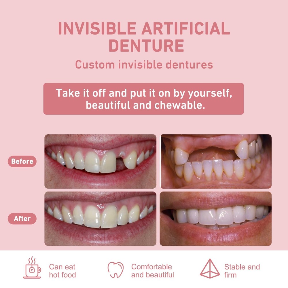 Custom Partial Dentures – Personalized Removable Denture Set for Missing Teet...