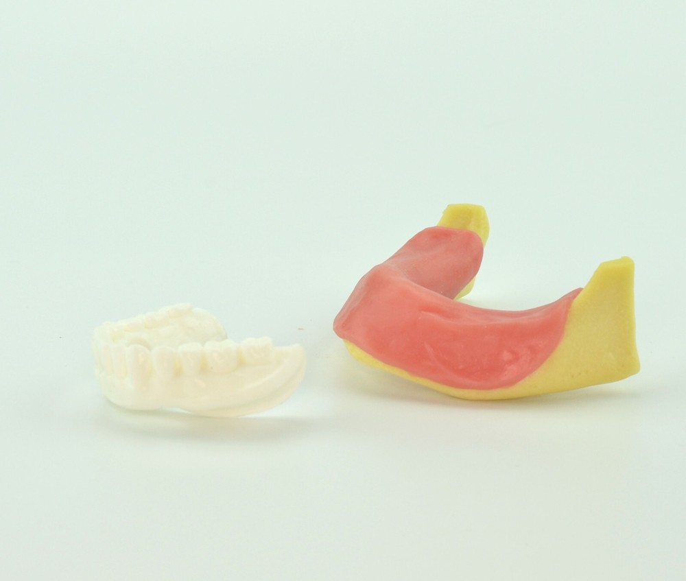 Dental Mandibular Implant Plus Denture Training Model Implant Placement