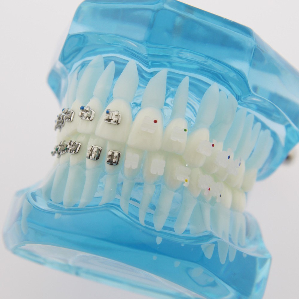 Dental Teach Study Typodont Teeth Model Half Metal Bracket Half Ceramic Bracket