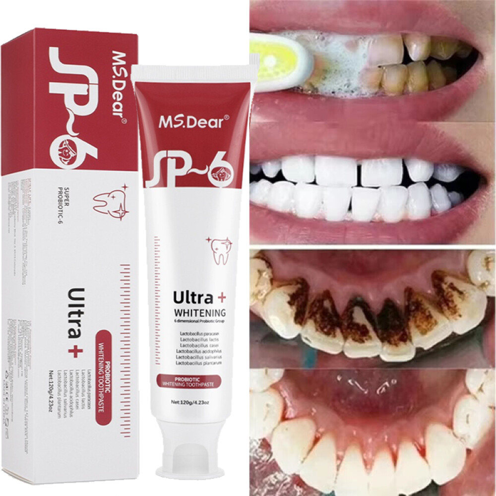 2Pcs Super Probiotic SP-6 Toothpaste, Probiotics Bright White Toothpaste, Sp 6
