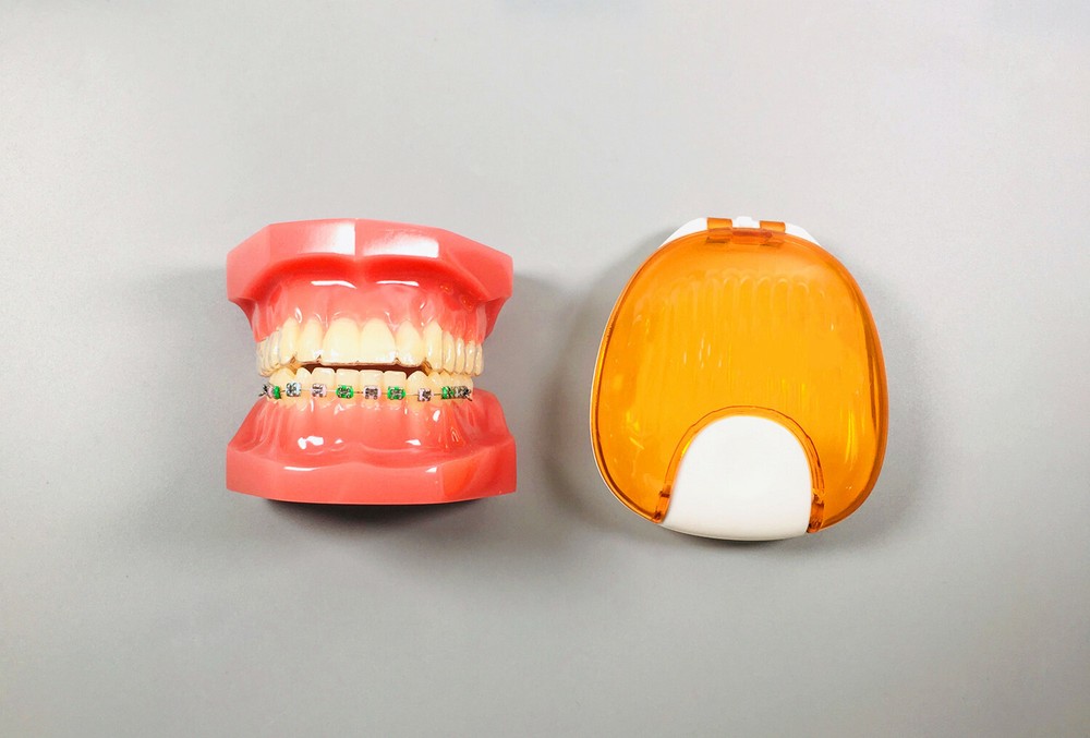 1Pc Dental Model Invisible Retainer Metal Brackets Contrast Aligner Comparison