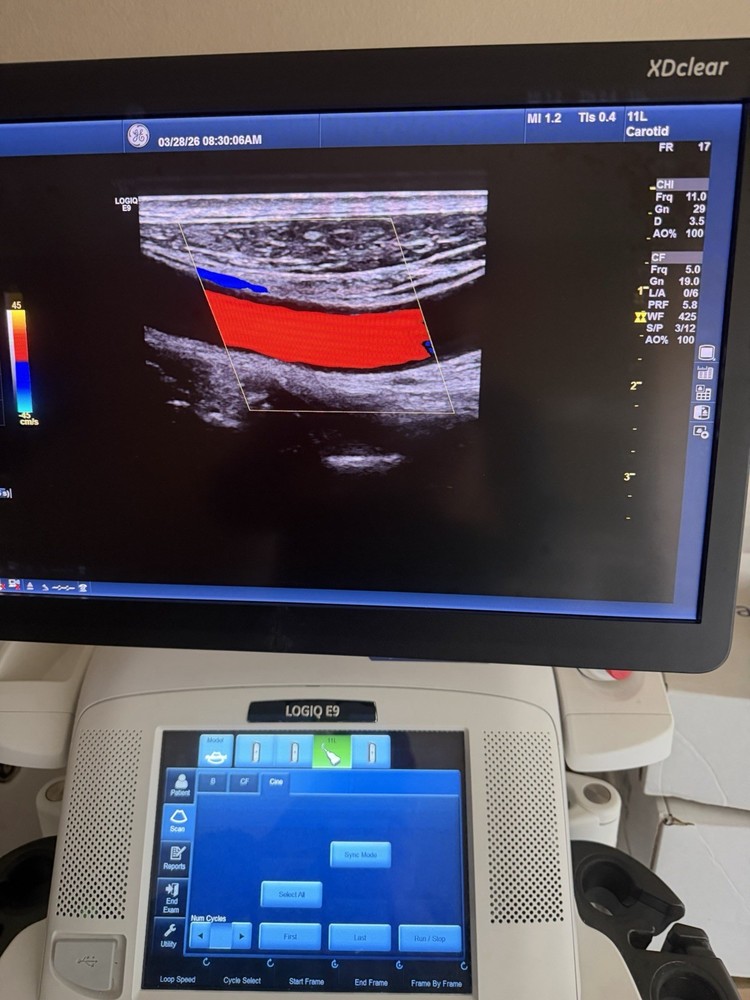 2017 GE 11 L D Probe Excellent working condition