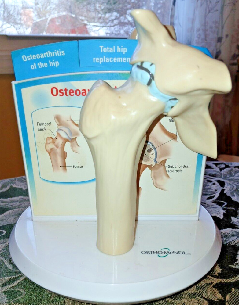 Anatstat ARTIFICIAL HIP JOINT REPLACEMENT Medical Anatomical Skeleton DEMO MODEL