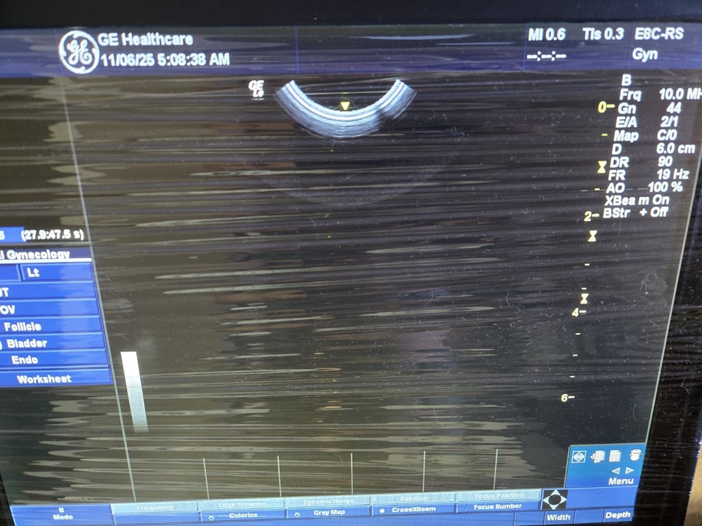 GE E8C-RS Ultrasound Probe / Transducer