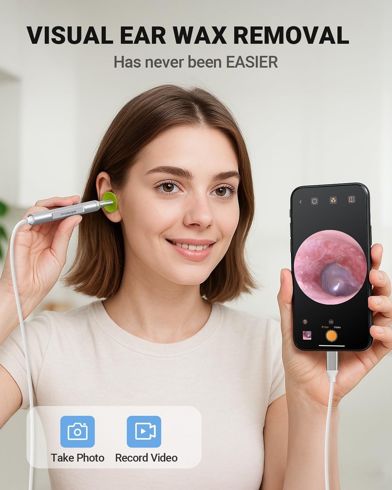 AnyScope Digital Otoscope Compatible with iPhone and Android Devices, HD Ear ...
