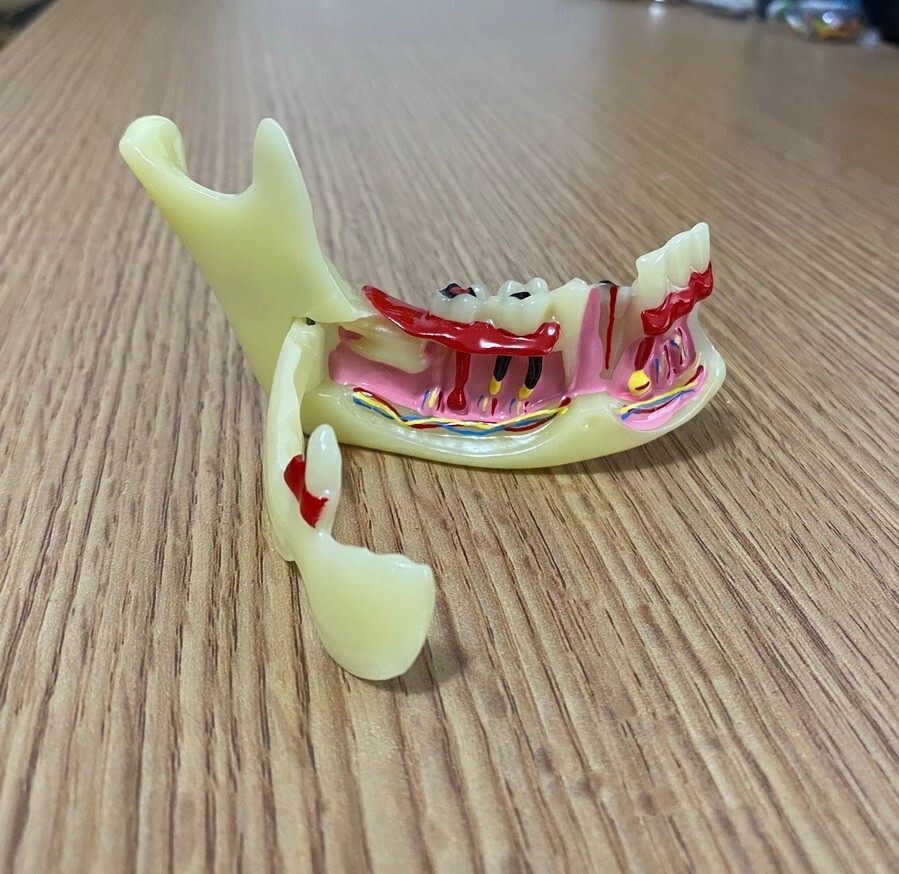Dental Mandibular Tissue Teeth Anatomical Model Patient Teach Study Model