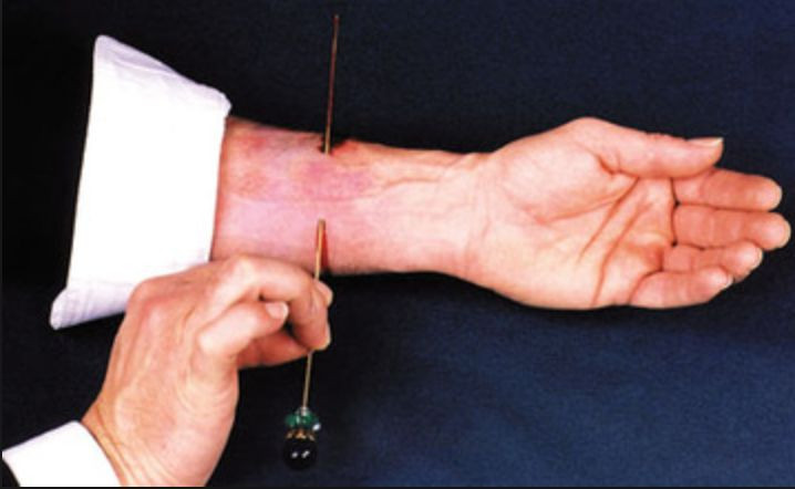 Needle Through Arm Magic Trick Illusion Horror Practical Joke Halloween Blood