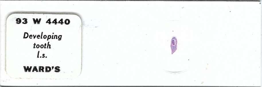 Developing Tooth Microscope Slide