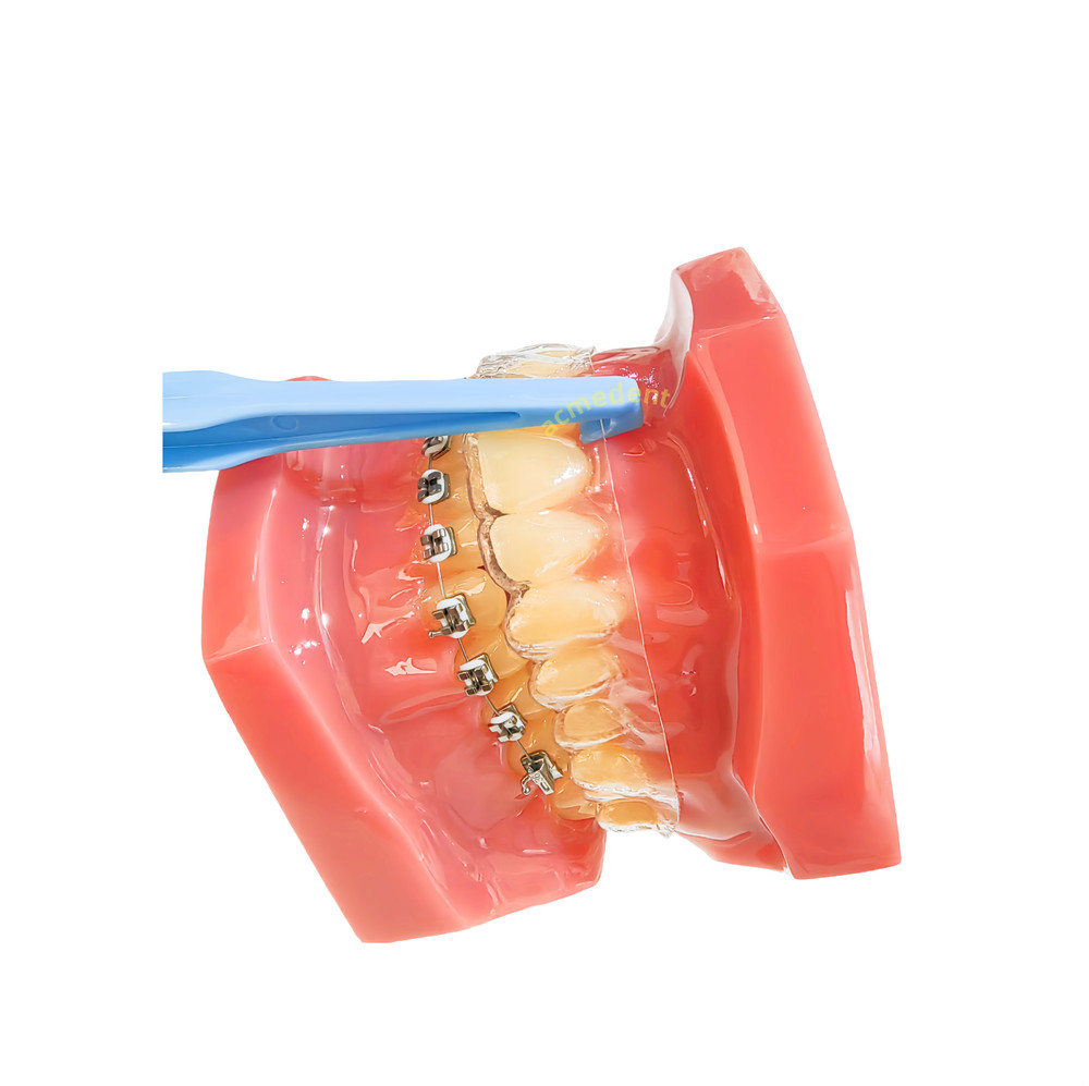 Dental Invisable Aligners Romover Clear Aligner Take off Upper Lower Retainer