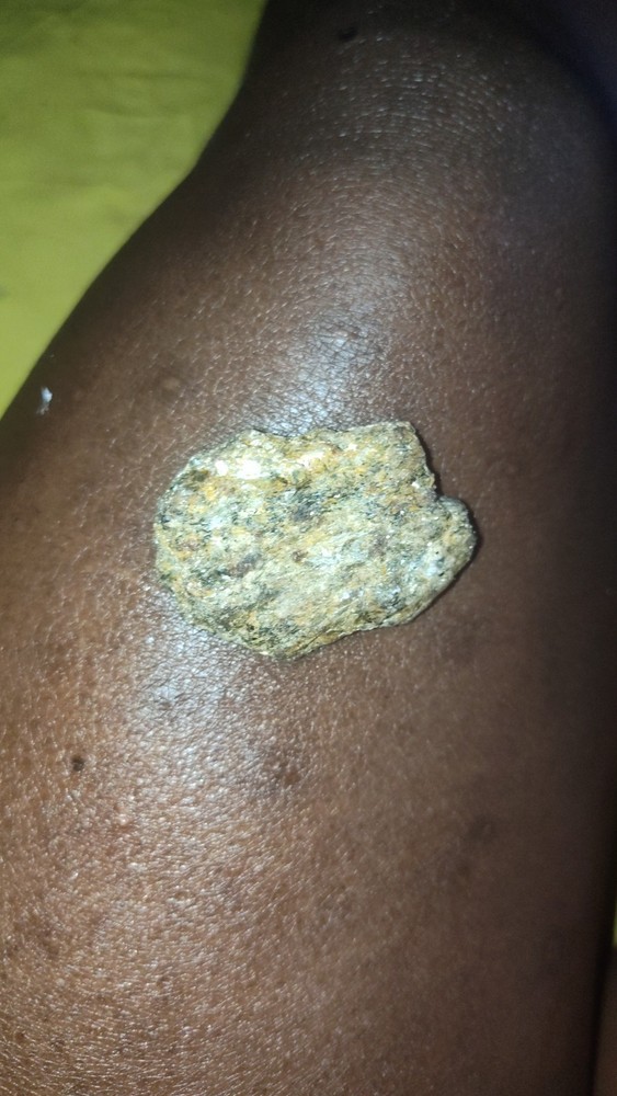 Raw Gold Platinum Rhodium Ore
