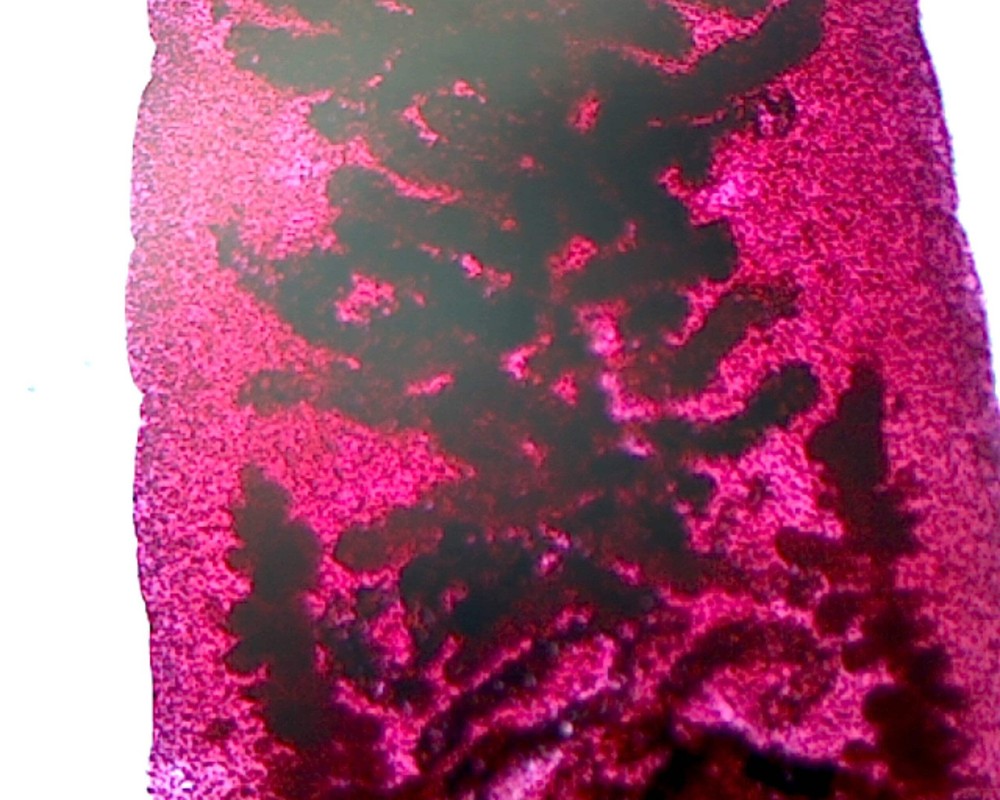 Fasciola Hepatica; Whole-mount