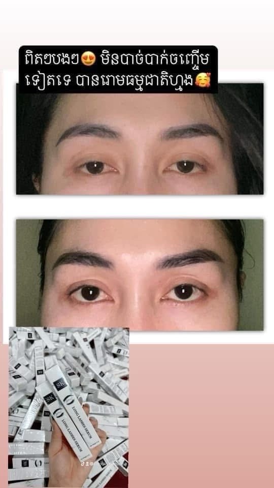 SK Long Lashes Serum សេរ៉ូមបណ្តុះរោមភ្នែក រោមចិញ្ចើម អោយវែង ( 1B / 5ml )